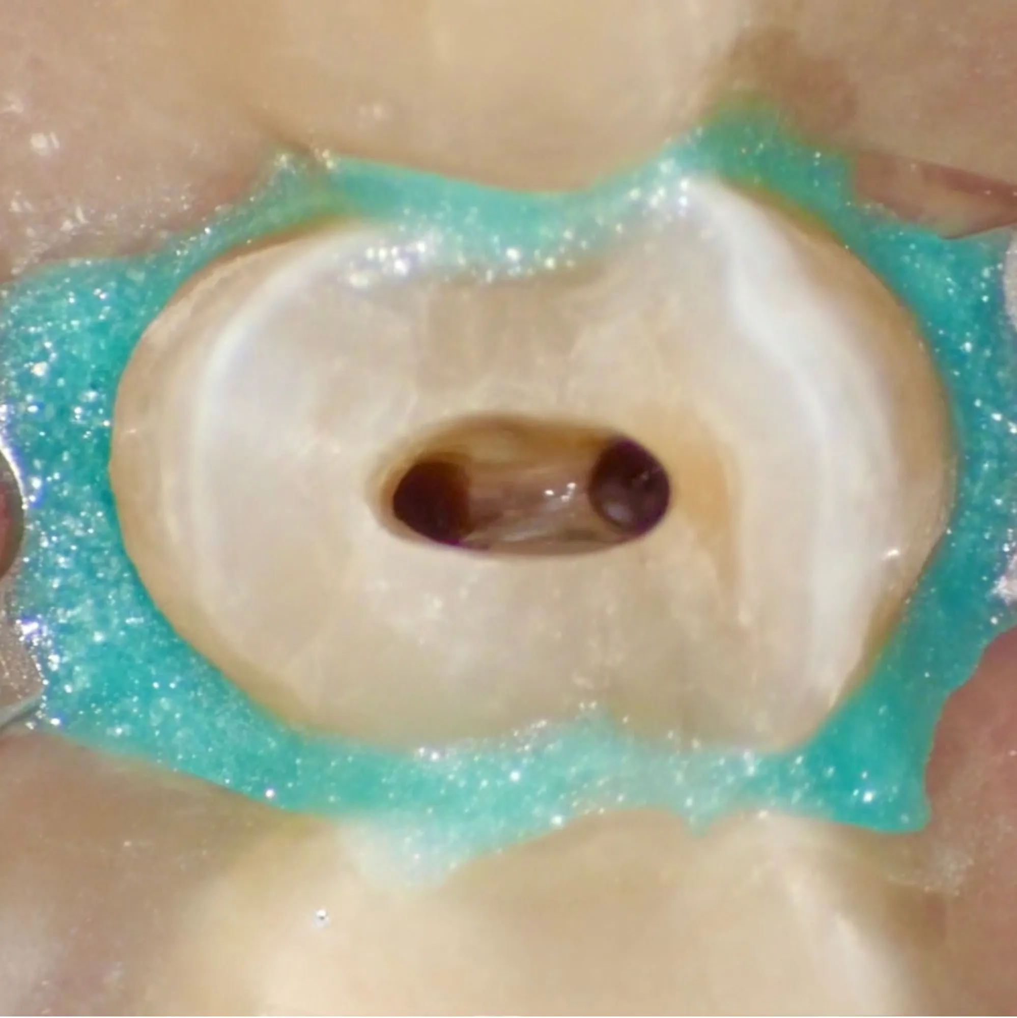 Endodonzia Ortograda